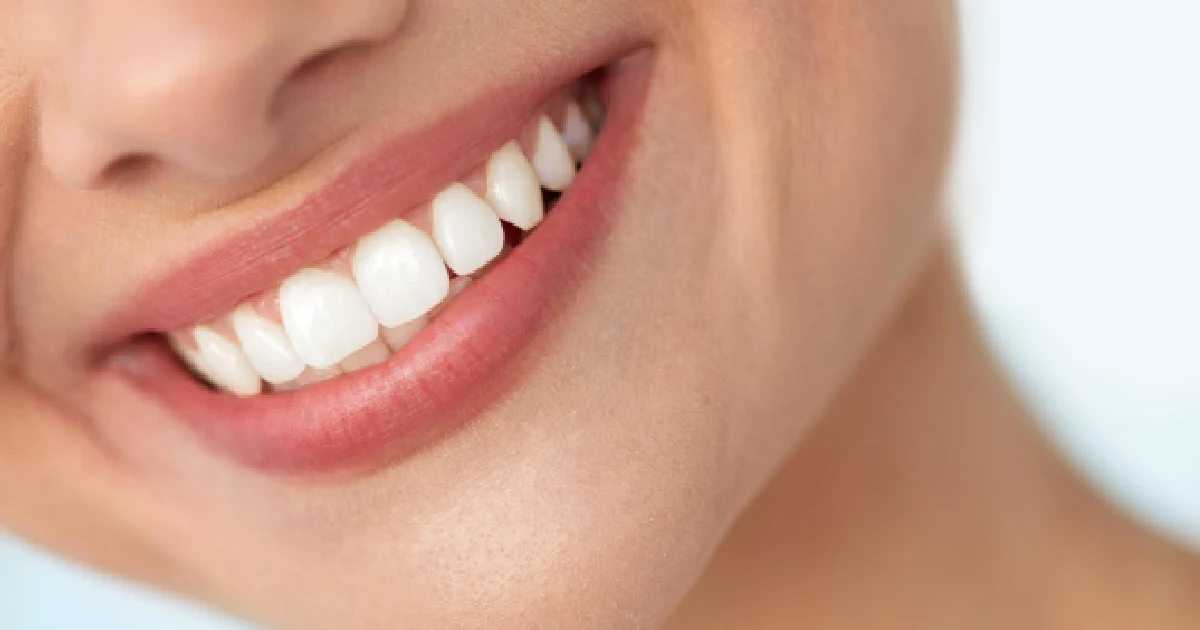women smile after laser teeth whitening treatment in Morristown, TN