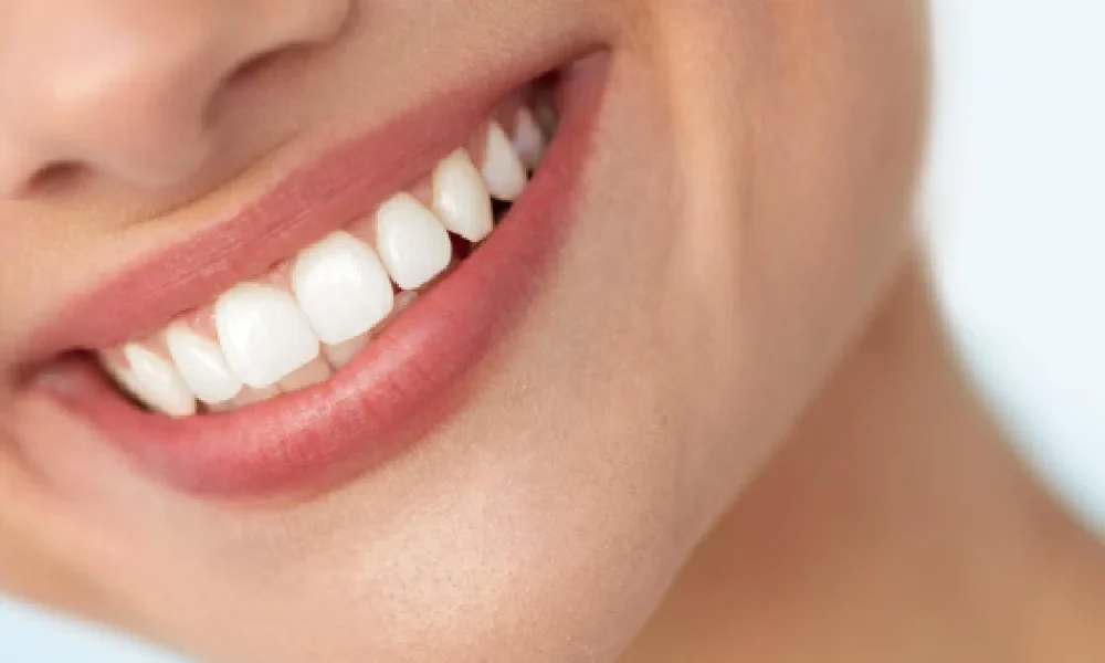 women smile after laser teeth whitening treatment in Morristown, TN