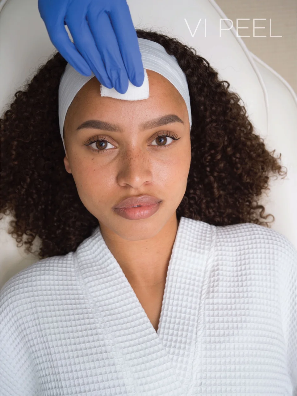 VI-peel-Urban-Radiance-Medical-Spa-in-Morristown-TN