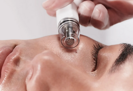 diamond-glow-facial