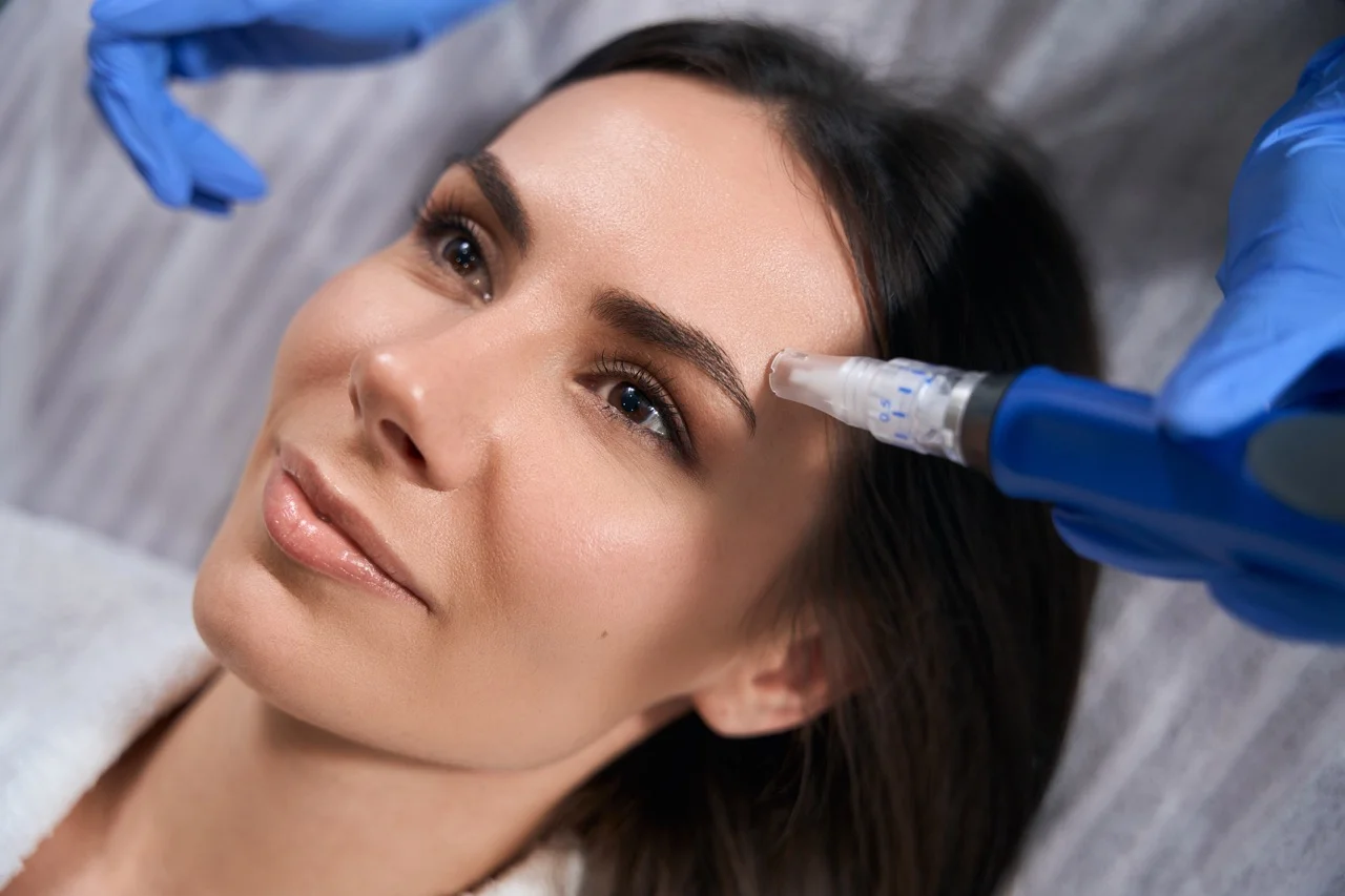 Microneedling